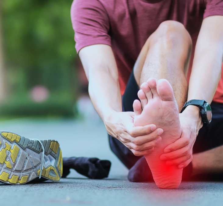 Plantar Fasciitis