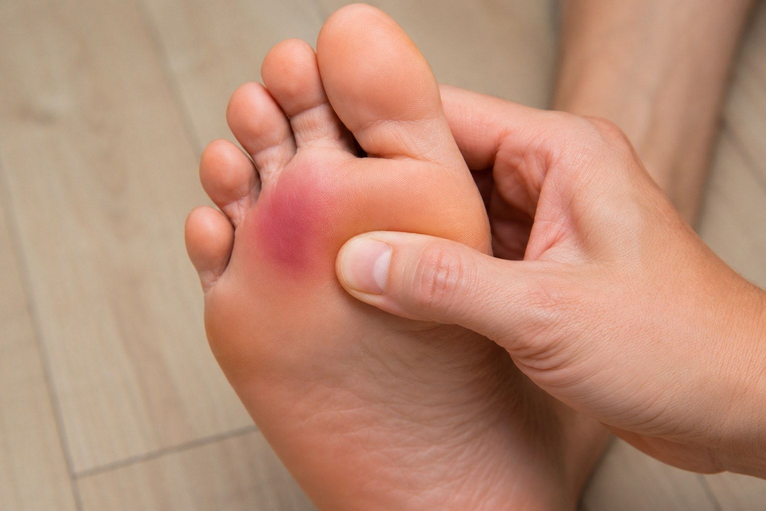 Morton's Neuroma
